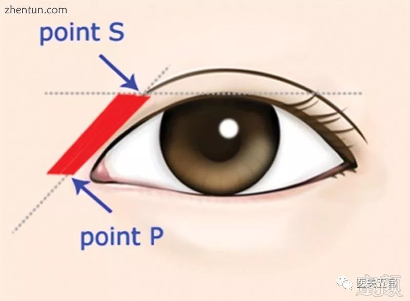https://img.miyanlife.com/mnt/timg/190413/12515L132-5.jpg
