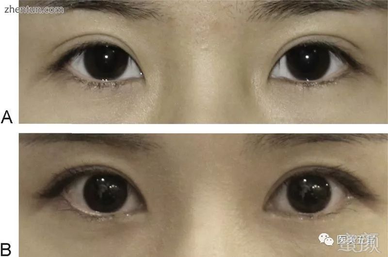 https://img.miyanlife.com/mnt/timg/190413/12515V458-9.jpg