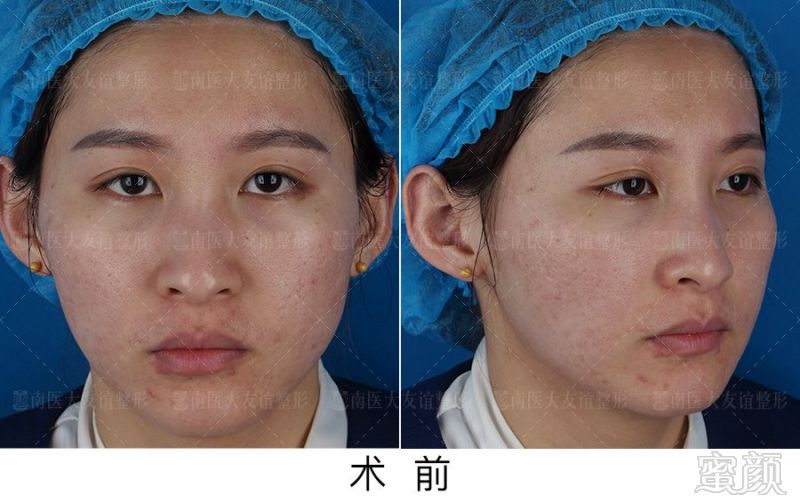 https://img.miyanlife.com/mnt/timg/190414/125IA204-8.jpg