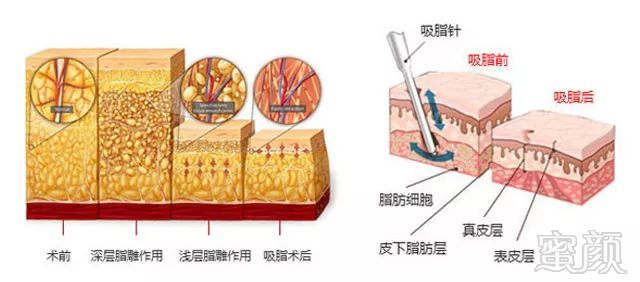 案例图片