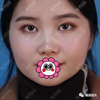 https://img.miyanlife.com/mnt/timg/190418/1150115292-0.jpg