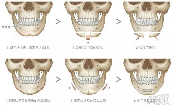 案例图片