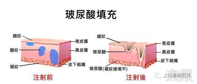 案例图片