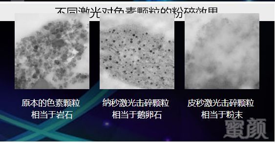 https://img.miyanlife.com/mnt/timg/190424/1332502242-4.jpg
