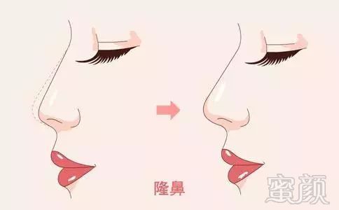 https://img.miyanlife.com/mnt/timg/190427/114Z4K28-0.jpg
