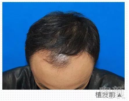 https://img.miyanlife.com/mnt/timg/190427/1152252128-0.jpg