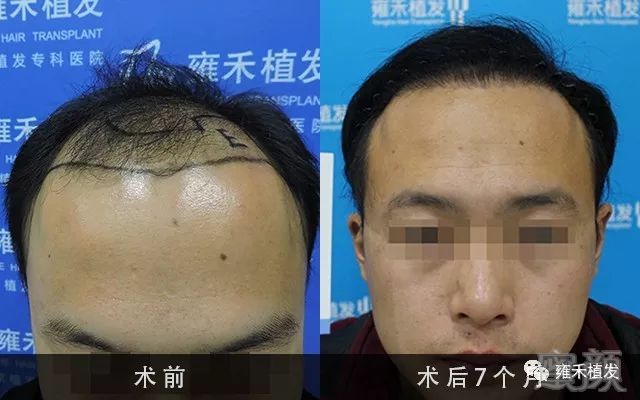 https://img.miyanlife.com/mnt/timg/190427/1153362620-0.jpg