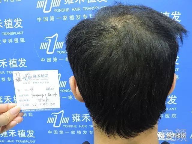 https://img.miyanlife.com/mnt/timg/190427/11533GI8-4.jpg