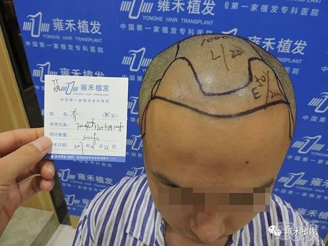 https://img.miyanlife.com/mnt/timg/190427/11533IF0-5.jpg