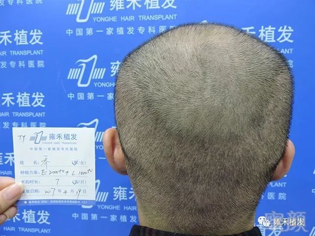 https://img.miyanlife.com/mnt/timg/190427/1153401T1-11.jpg