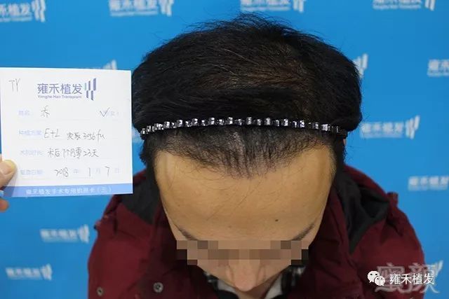https://img.miyanlife.com/mnt/timg/190427/11534252E-15.jpg