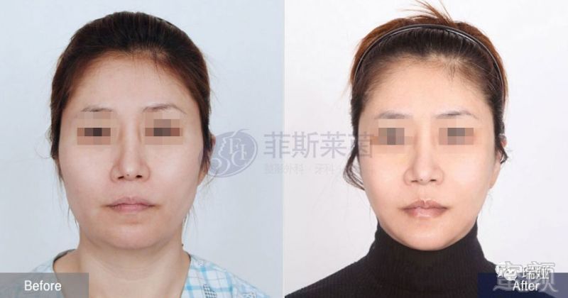https://img.miyanlife.com/mnt/timg/190427/124054N54-2.jpg
