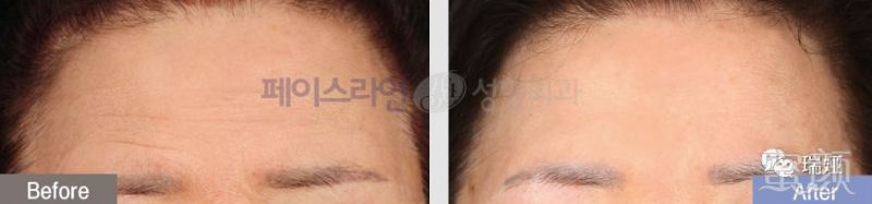 https://img.miyanlife.com/mnt/timg/190427/1240554421-3.jpg