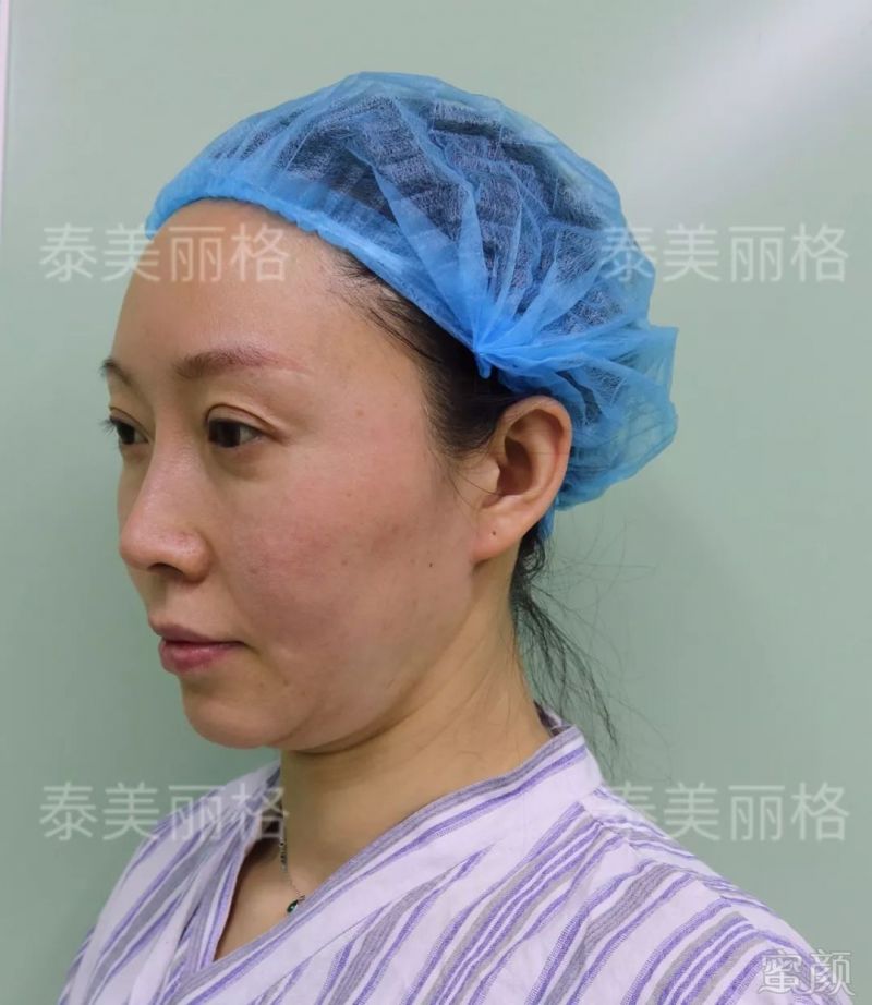 https://img.miyanlife.com/mnt/timg/190428/105Z4JL-0.jpg