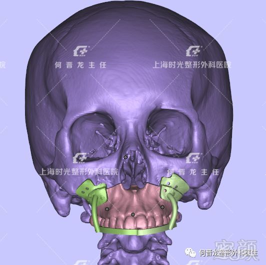 案例图片