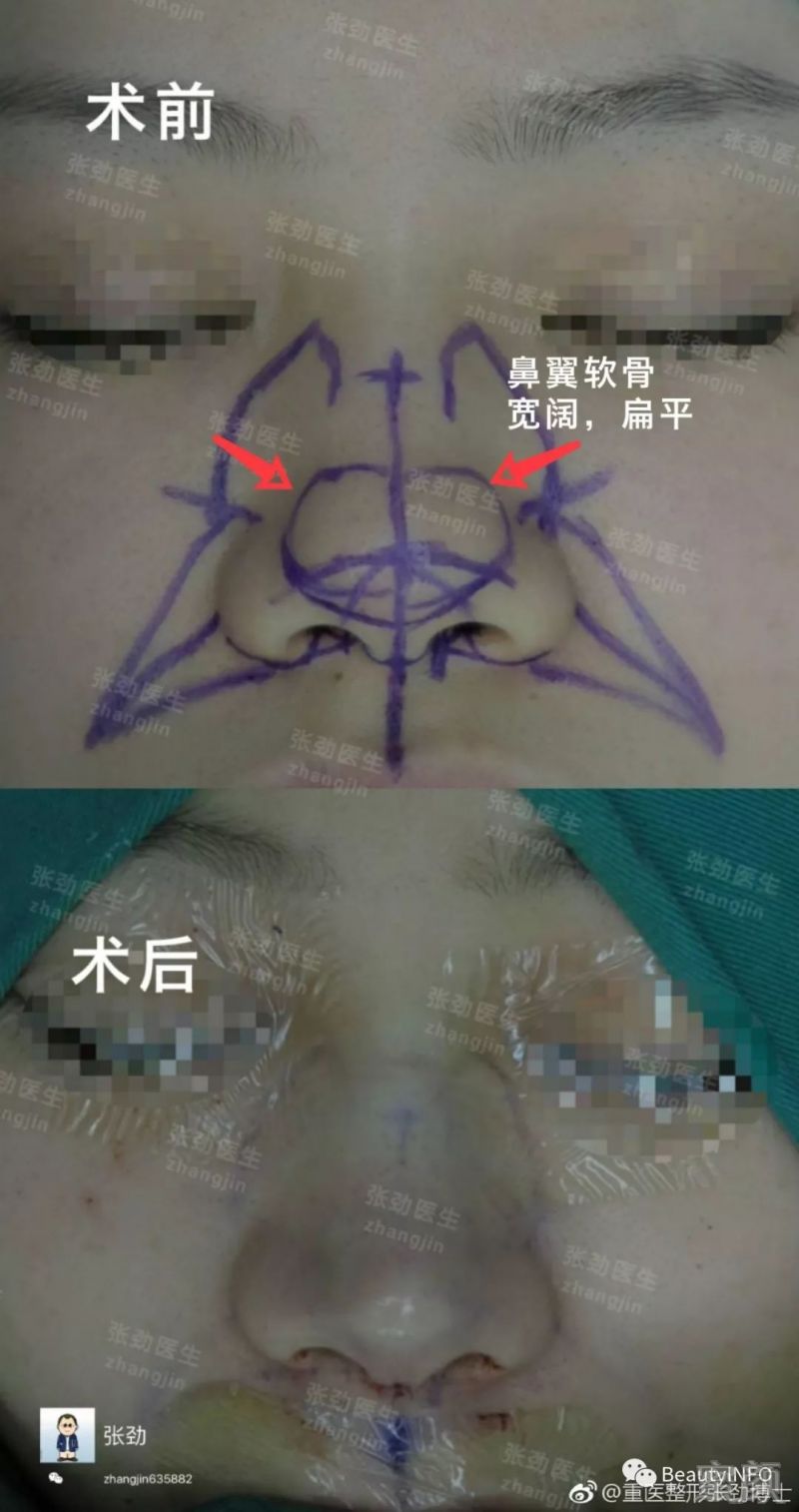 https://img.miyanlife.com/mnt/timg/190428/115145G40-1.jpg