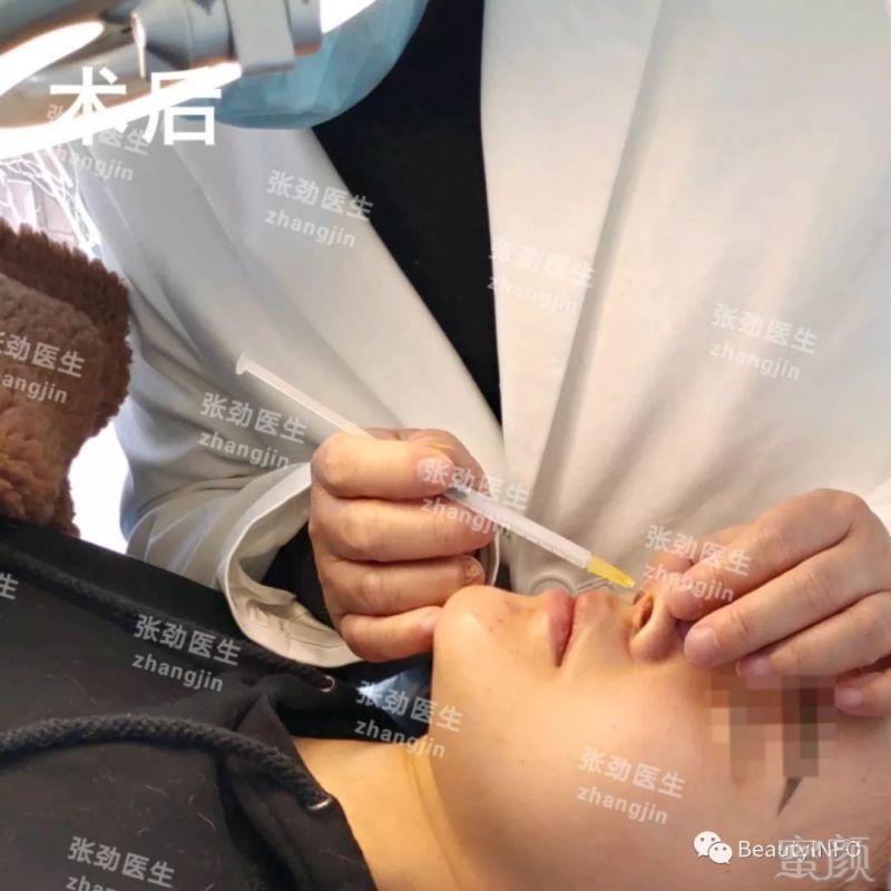 https://img.miyanlife.com/mnt/timg/190428/1152051W6-6.jpg