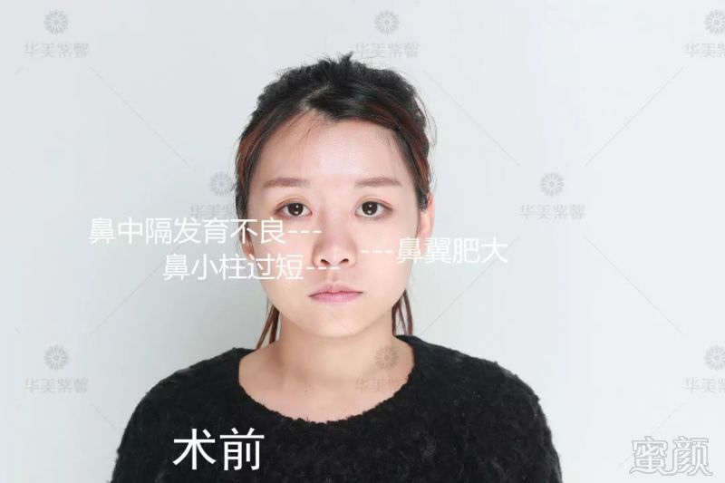 https://img.miyanlife.com/mnt/timg/190430/1103534918-3.jpg
