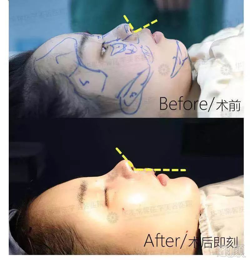https://img.miyanlife.com/mnt/timg/190430/110400G96-13.jpg