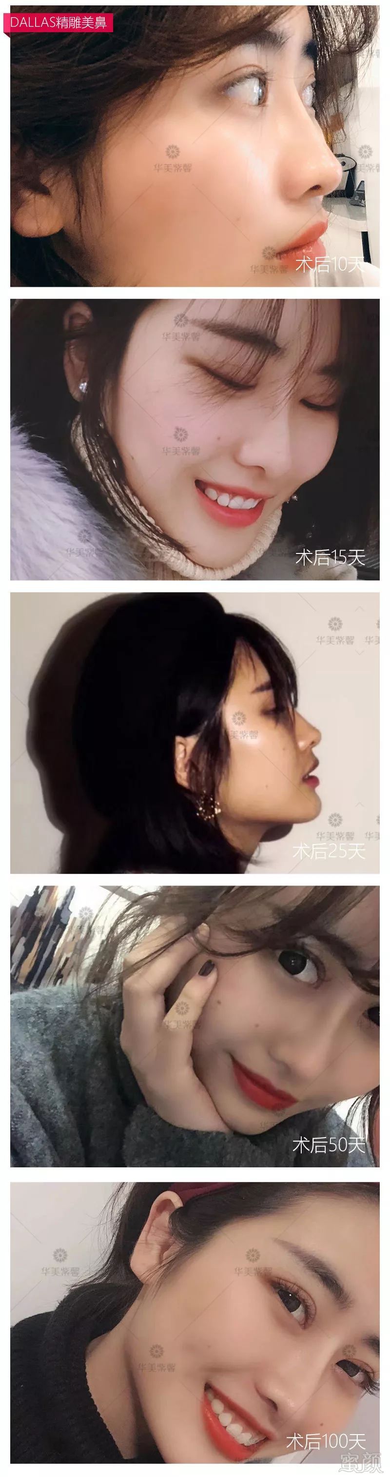 https://img.miyanlife.com/mnt/timg/190430/1104012H8-15.jpg
