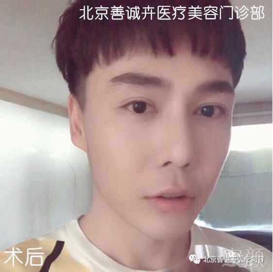 https://img.miyanlife.com/mnt/timg/190430/1144442041-5.jpg