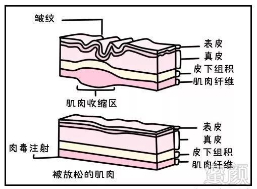 https://img.miyanlife.com/mnt/timg/190501/1314123335-0.jpg