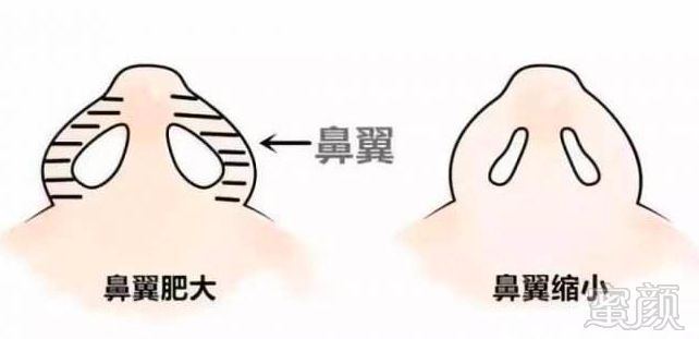 https://img.miyanlife.com/mnt/timg/190501/1314152509-4.jpg