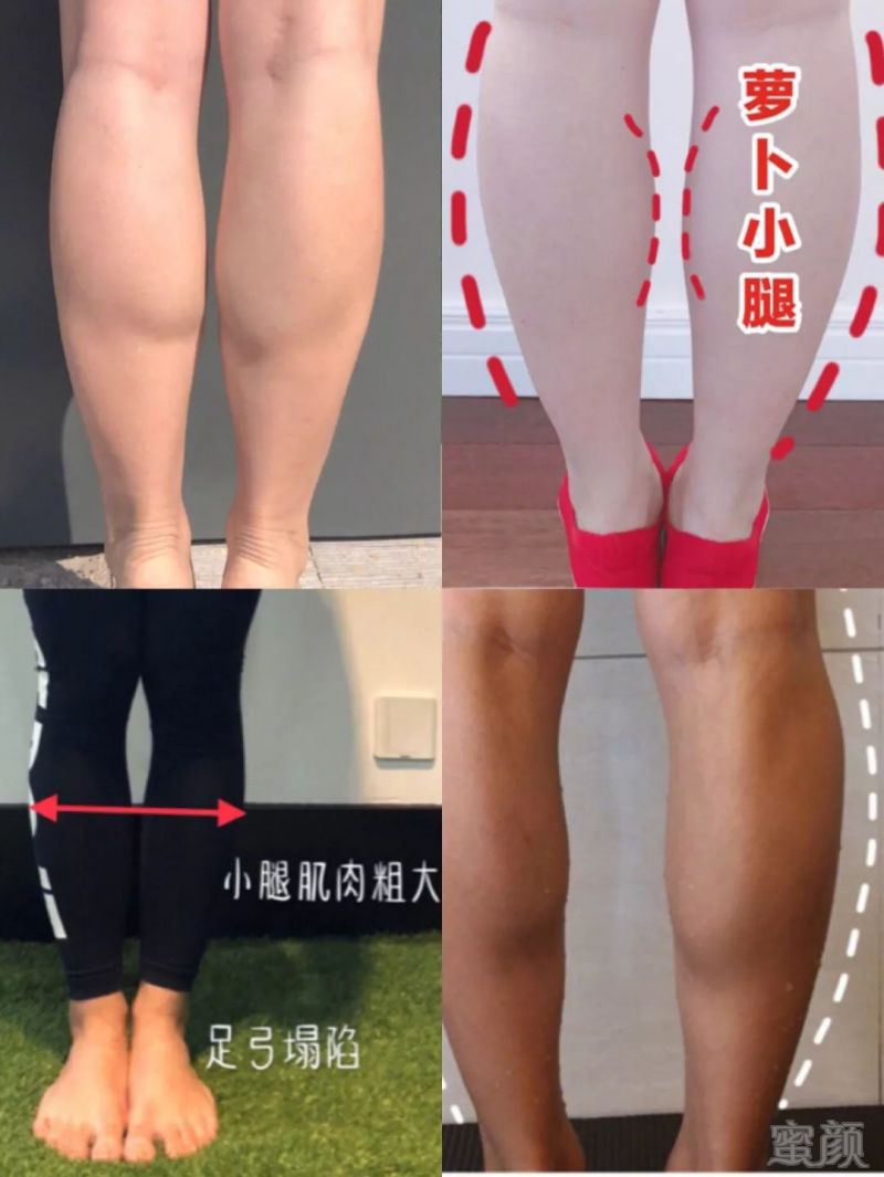 https://img.miyanlife.com/mnt/timg/190501/1314194C2-13.jpg