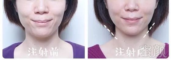https://img.miyanlife.com/mnt/timg/190501/13141R395-10.jpg