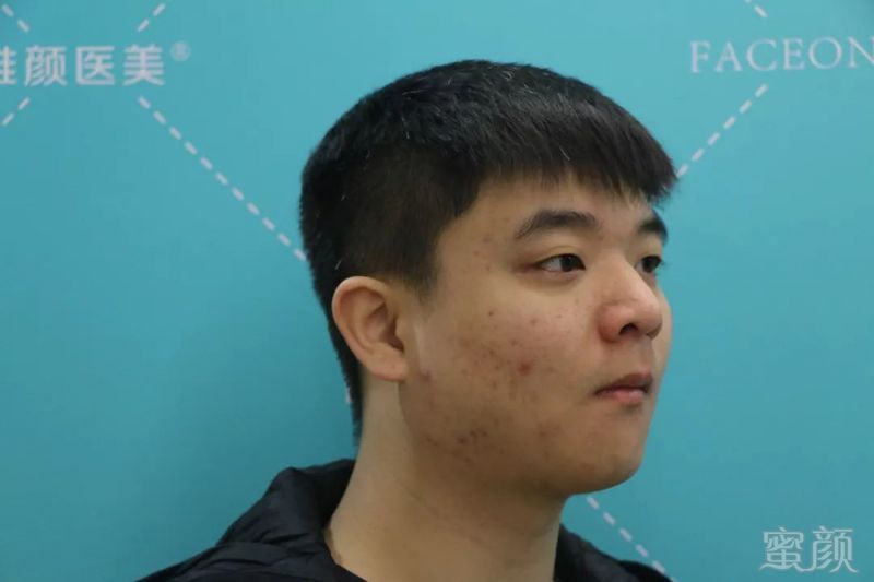 https://img.miyanlife.com/mnt/timg/190501/13143W014-2.jpg