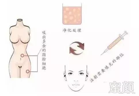https://img.miyanlife.com/mnt/timg/190501/1332504K0-2.jpg