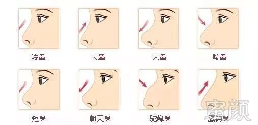 https://img.miyanlife.com/mnt/timg/190501/13354212T-5.jpg