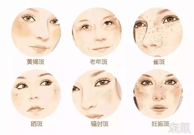 https://img.miyanlife.com/mnt/timg/190502/113243OR-1.jpg