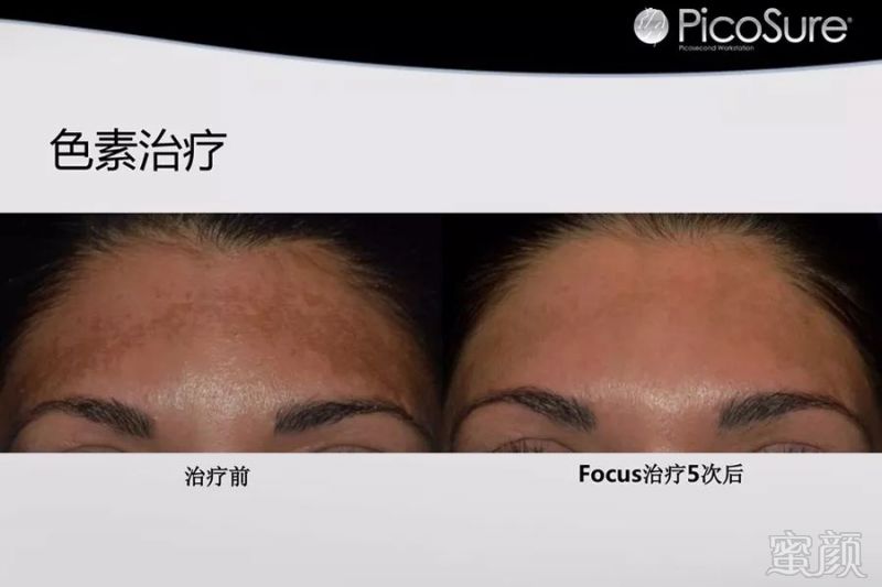 https://img.miyanlife.com/mnt/timg/190502/1135061253-3.jpg