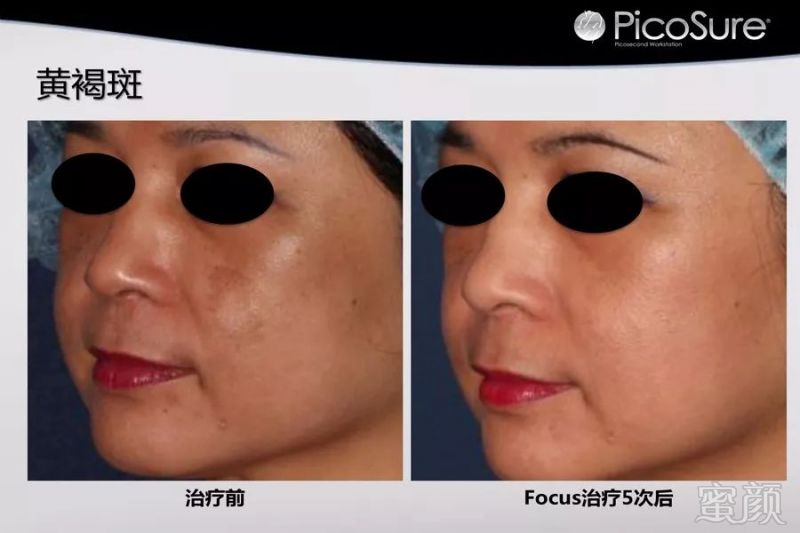 https://img.miyanlife.com/mnt/timg/190502/11350Q2F-5.jpg