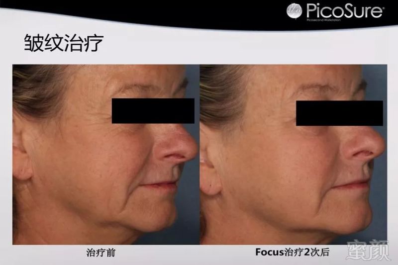 https://img.miyanlife.com/mnt/timg/190502/113511GU-7.jpg
