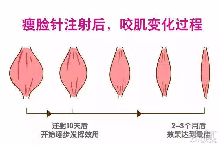 https://img.miyanlife.com/mnt/timg/190502/11394I434-9.jpg