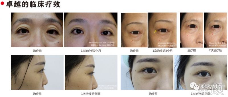 https://img.miyanlife.com/mnt/timg/190502/113KW0c-2.jpg
