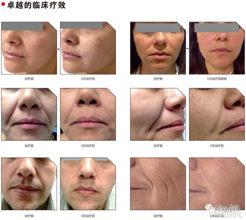 https://img.miyanlife.com/mnt/timg/190502/113P011S-3.jpg