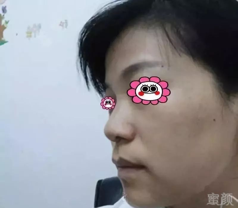 https://img.miyanlife.com/mnt/timg/190502/113T13c7-0.jpg