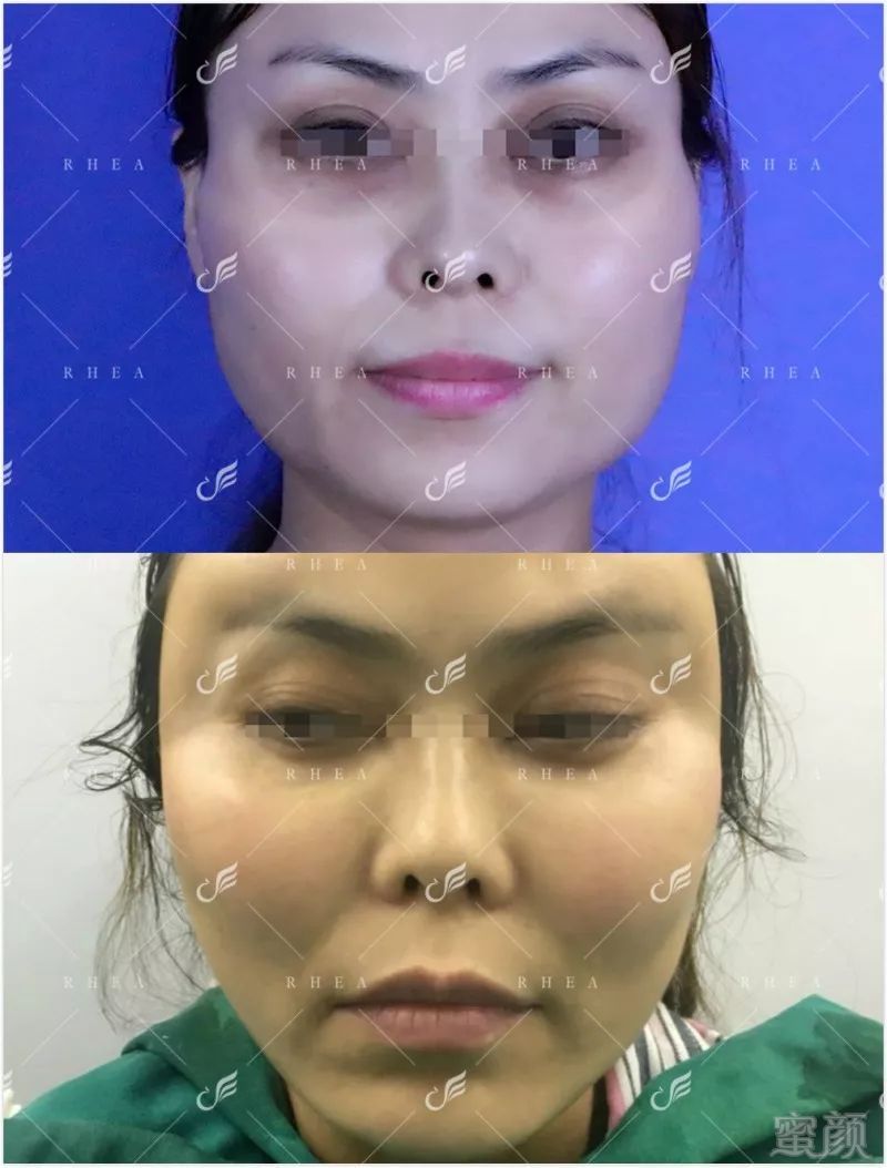 https://img.miyanlife.com/mnt/timg/190502/11462RJ1-9.jpg