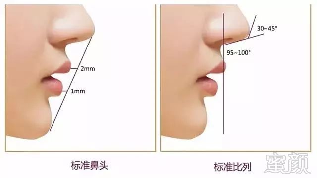 https://img.miyanlife.com/mnt/timg/190502/1205394296-7.jpg