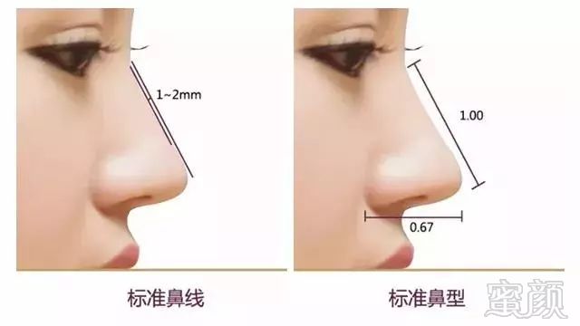 https://img.miyanlife.com/mnt/timg/190502/1205394Q1-6.jpg