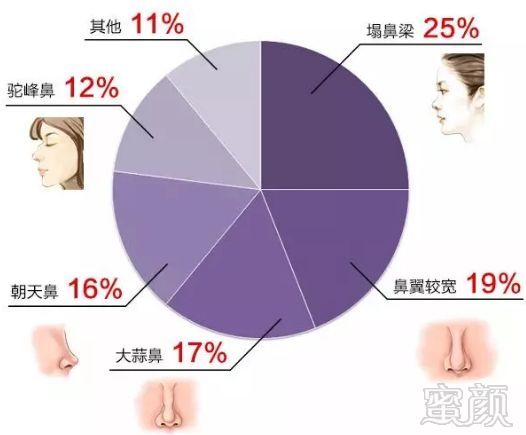 https://img.miyanlife.com/mnt/timg/190502/12053R546-2.jpg