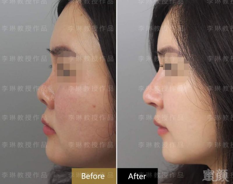 https://img.miyanlife.com/mnt/timg/190502/120544BA-13.jpg