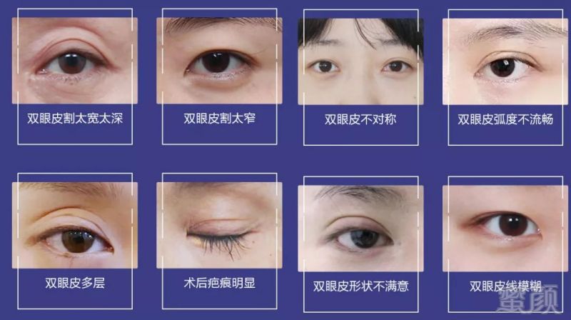 https://img.miyanlife.com/mnt/timg/190502/1211112047-0.jpg