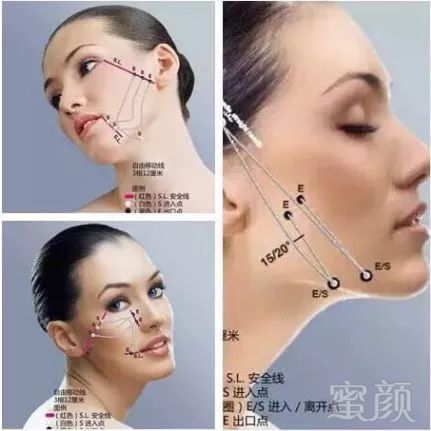 https://img.miyanlife.com/mnt/timg/190503/1013303H5-12.jpg