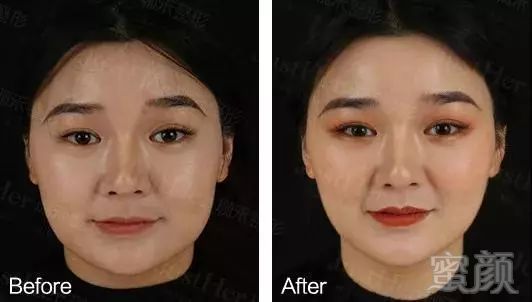 https://img.miyanlife.com/mnt/timg/190503/1015151U7-4.jpg