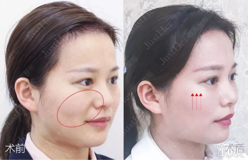 https://img.miyanlife.com/mnt/timg/190503/1015193014-9.jpg