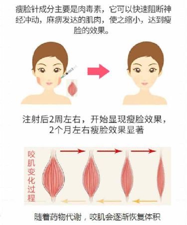 https://img.miyanlife.com/mnt/timg/190503/10151A0c-7.jpg